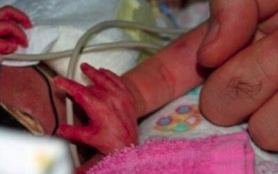 Prematurity and Infants